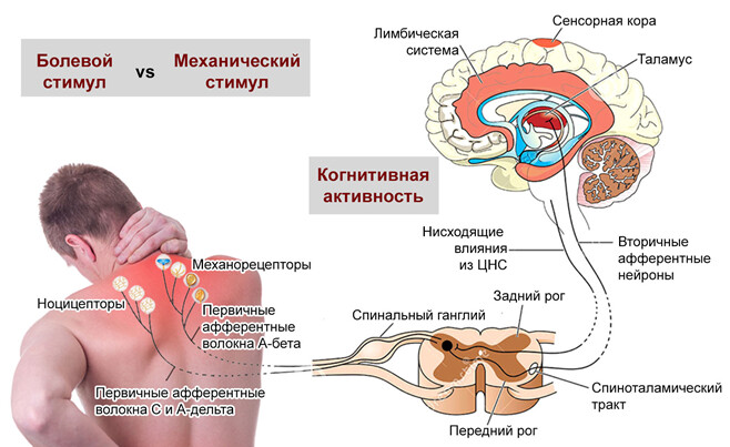 Механизм появления мышечной боли - миалгии Механизм появления мышечной боли - миалгии