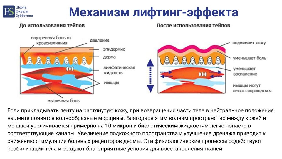 Механизм лифтинг-эффекта от тейпирования