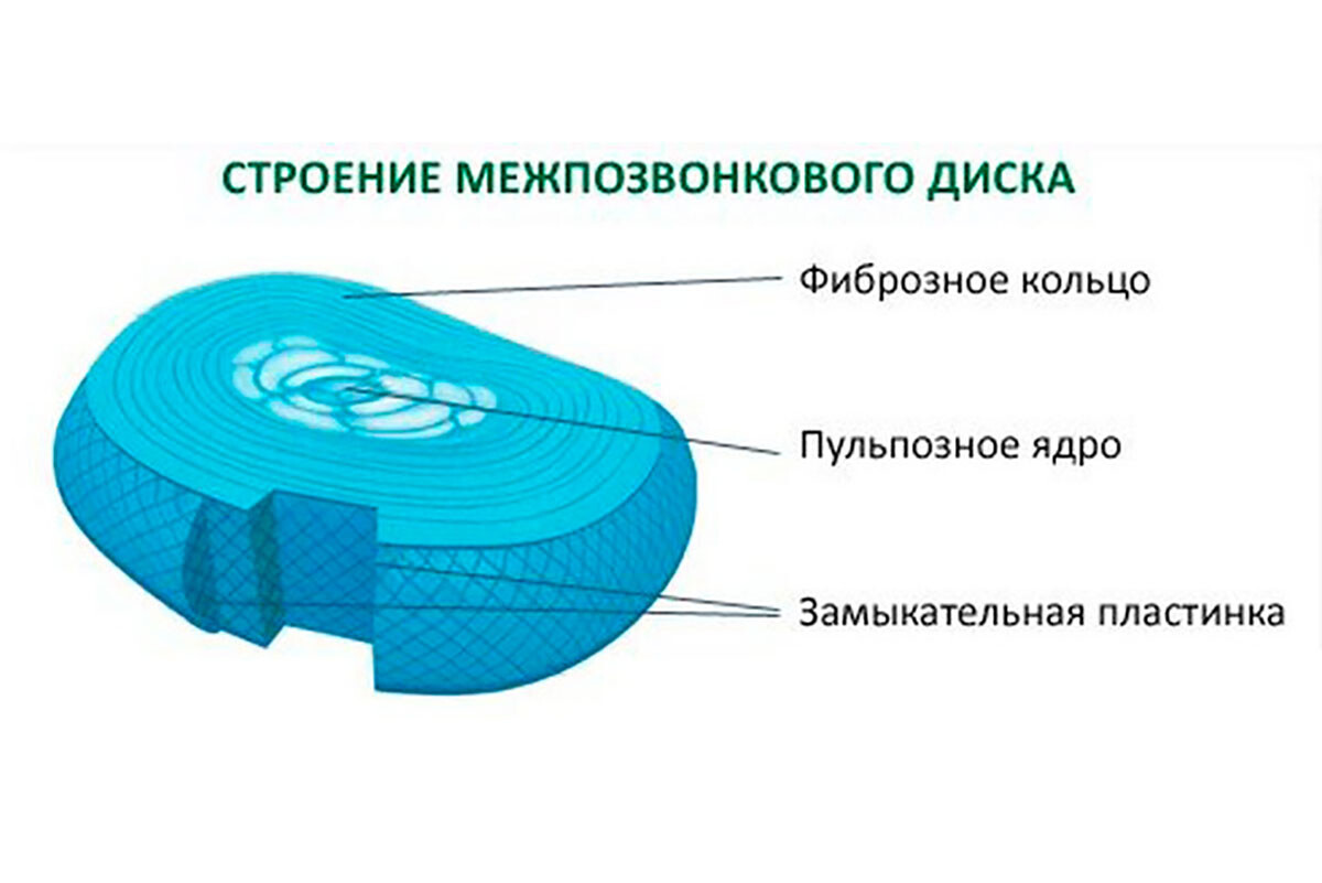 Строение межпозвонкового диска