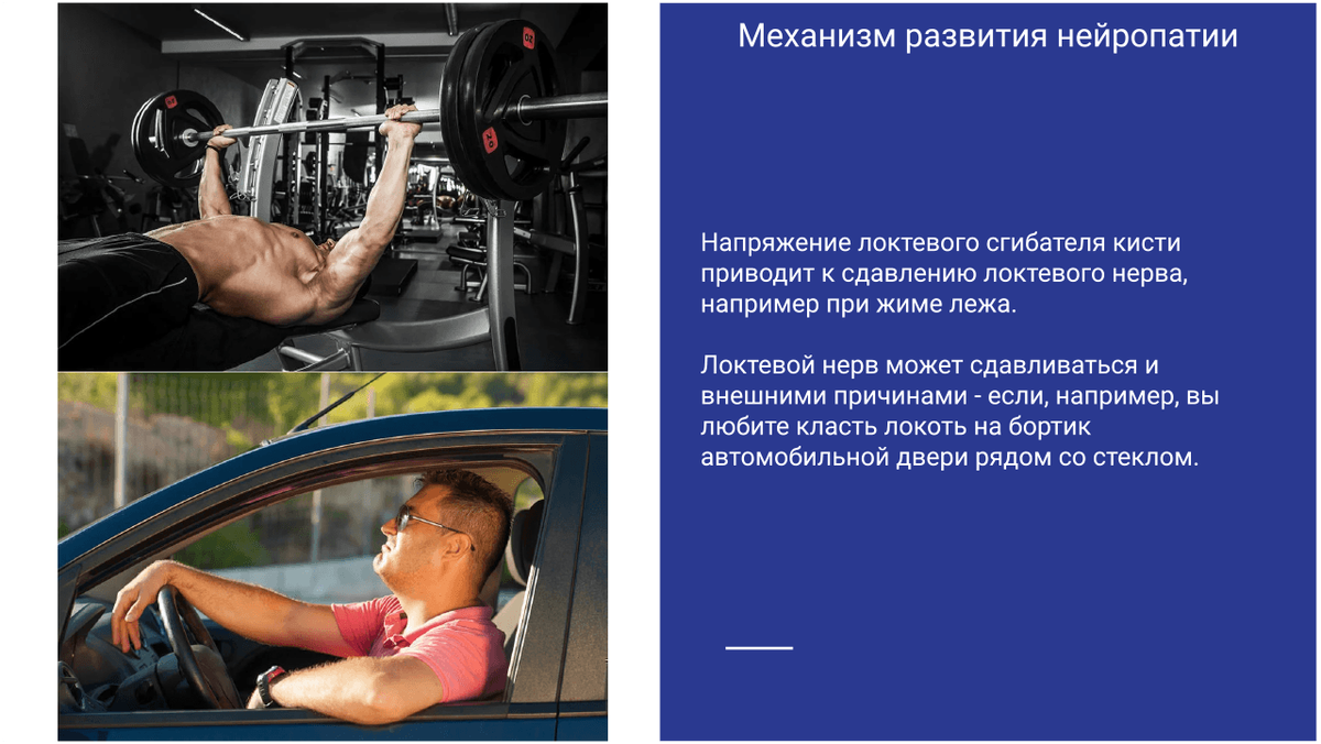 Механизм развития нейропатии Механизм развития нейропатии