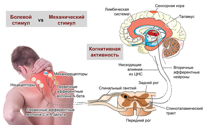 Механизм появления мышечной боли - миалгии