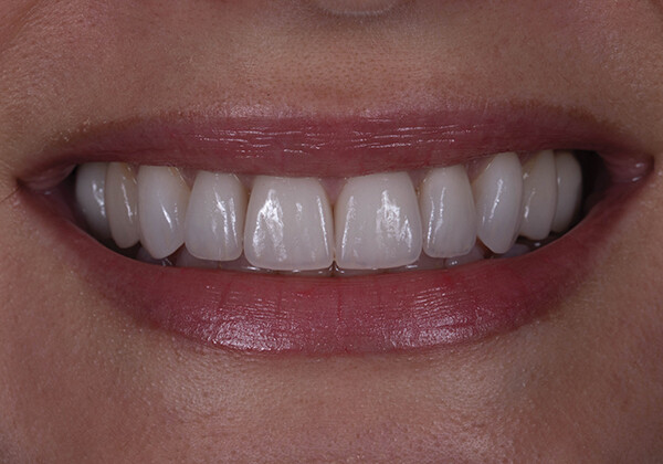 
		
		<p>
		Рис. 13</p>		