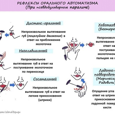 Неврология в схемах и таблицах