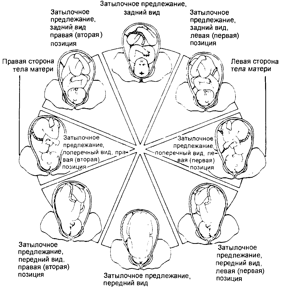 Положение плода картинки