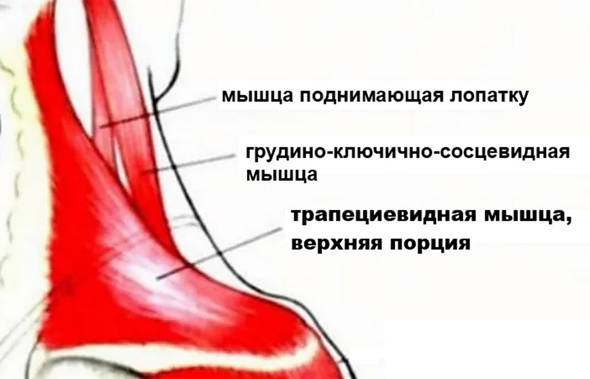 Мышцы шеи и надплечий: верхняя порция m. trapezius, m. levator scapulae, m. sternocleidomastoideus.