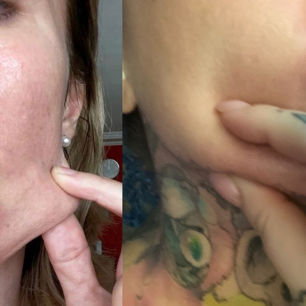 <p>
		<em>Слева — ела мало белка, плохой коллаген с поломанными структурами молекул</em></p><p><em>Справа — ем много белка, старше на 6 лет, хорошие добавки с коллагеном</em></p>