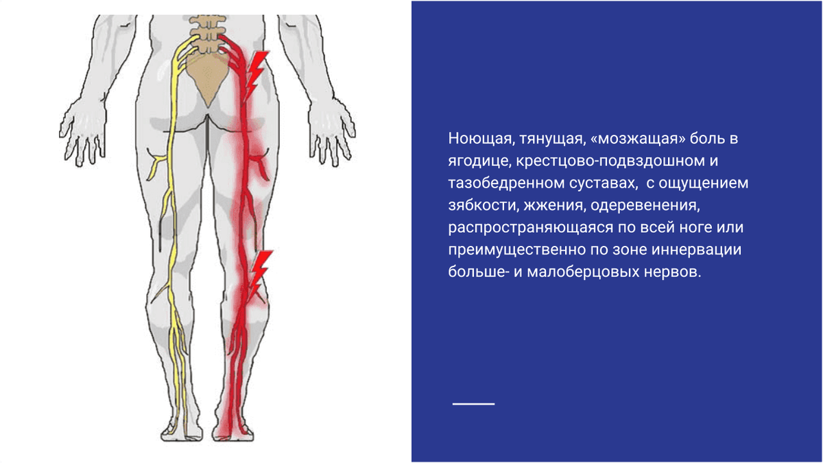 Клиническая картина поли х синдрома у женщин характеризуется