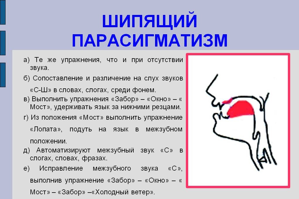 Нарушение артикуляционных схем отдельных звуков является первичным дефектом при