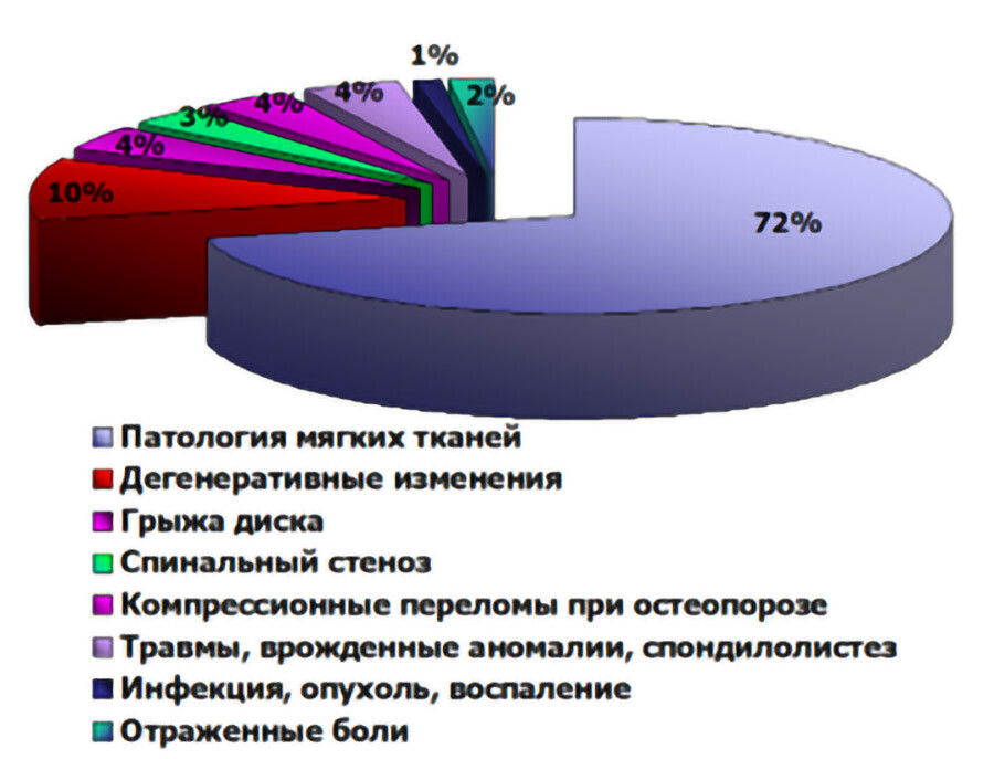 Статистика причин боли в позвоночнике