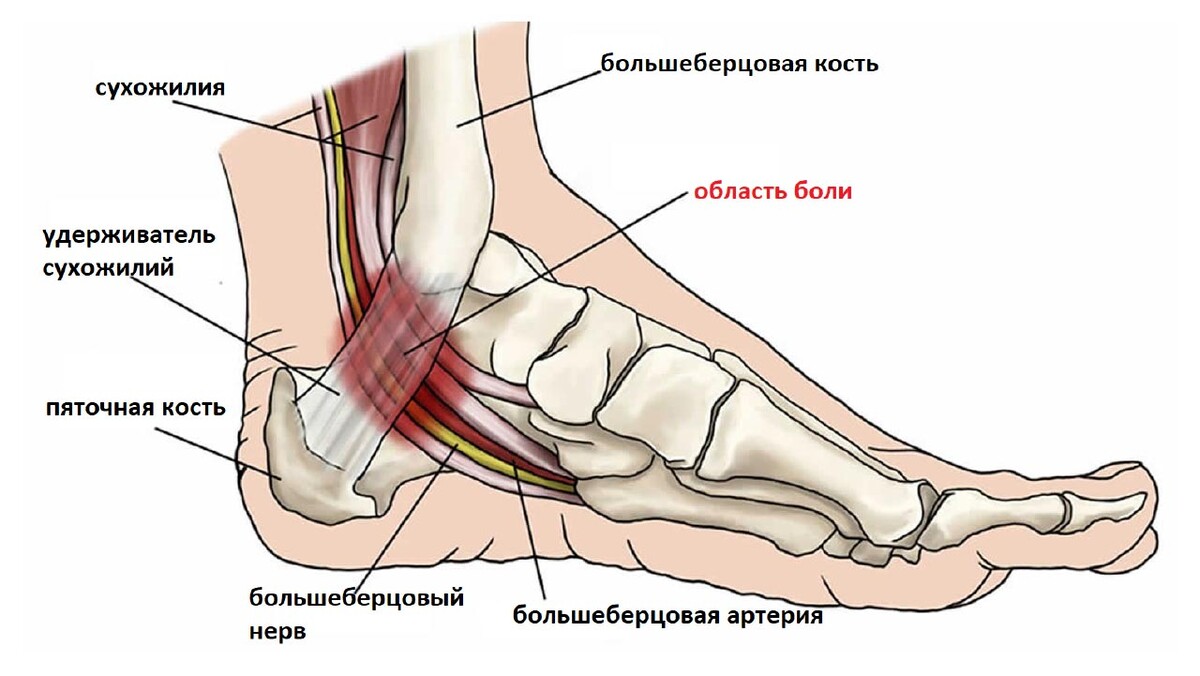 Большеберцовый нерв