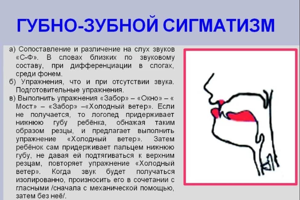 Миофункциональные нарушения | eirc-ram.ru | Дзен