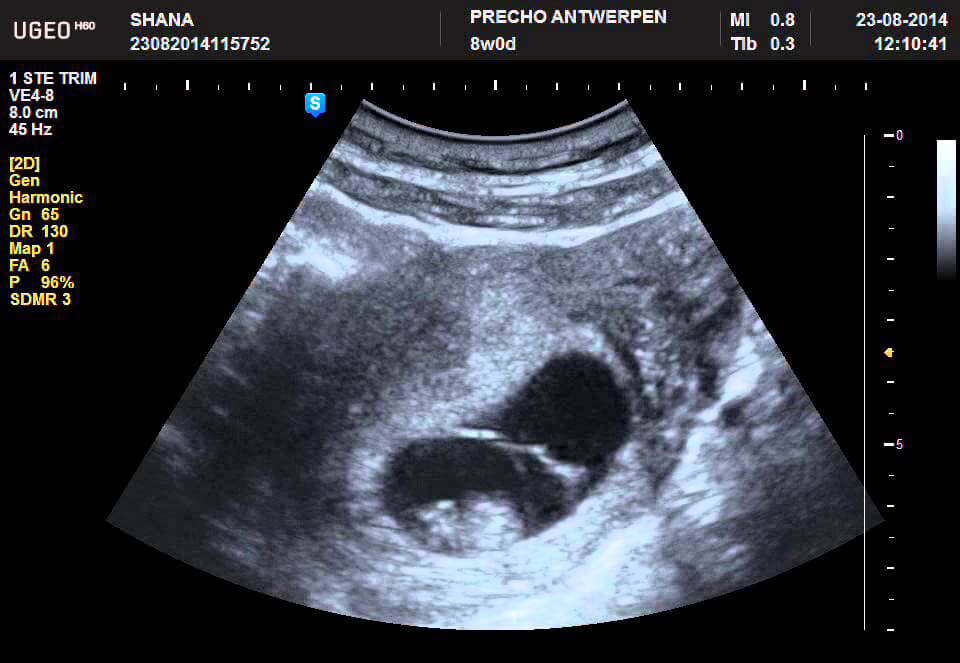 8 неделя беременности от зачатия
