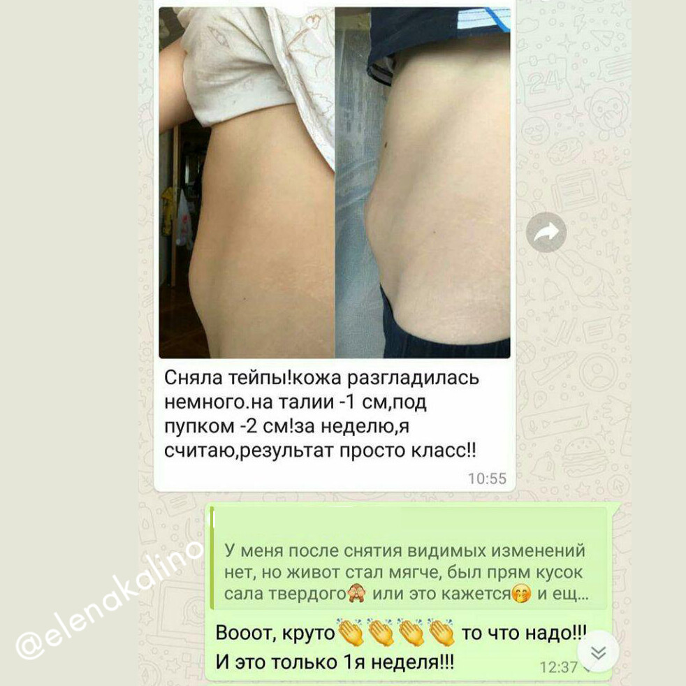 Тейпирование для похудения до и после