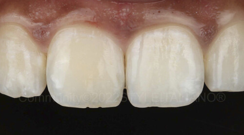 
		
		
		
		<p>
		Рис. 15</p>				