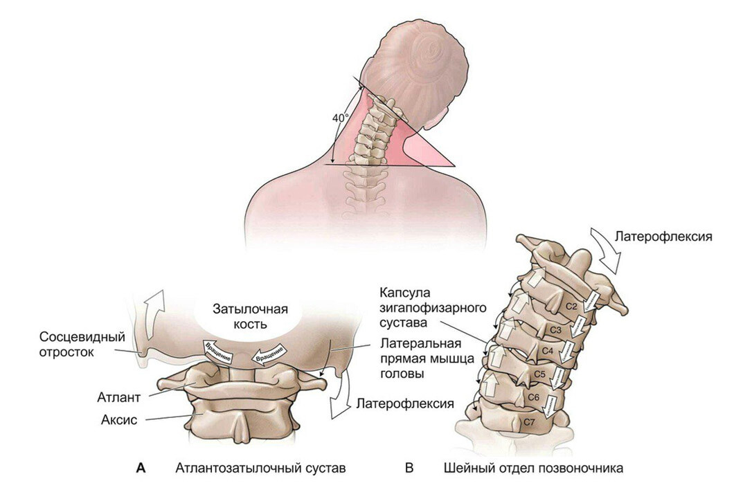 Латерофлексия в нижне-шейном отделе позвоночника