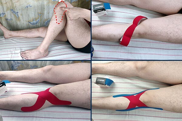 Клиническое значение